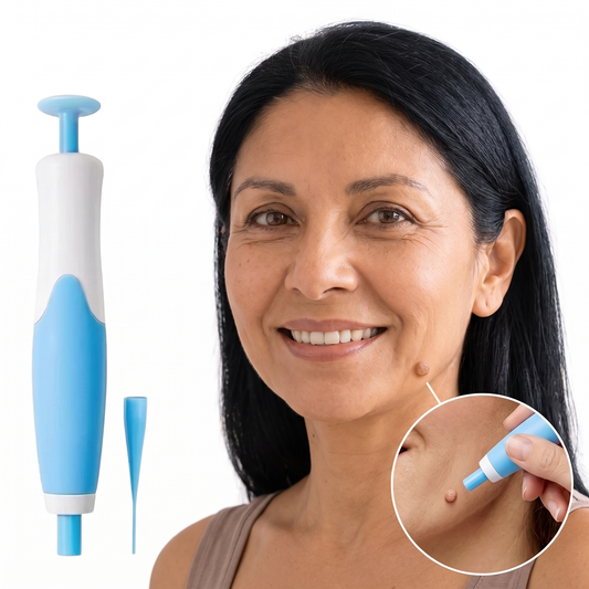 Kit Dervalon™ Removedor de Verrugas y Acrocordones